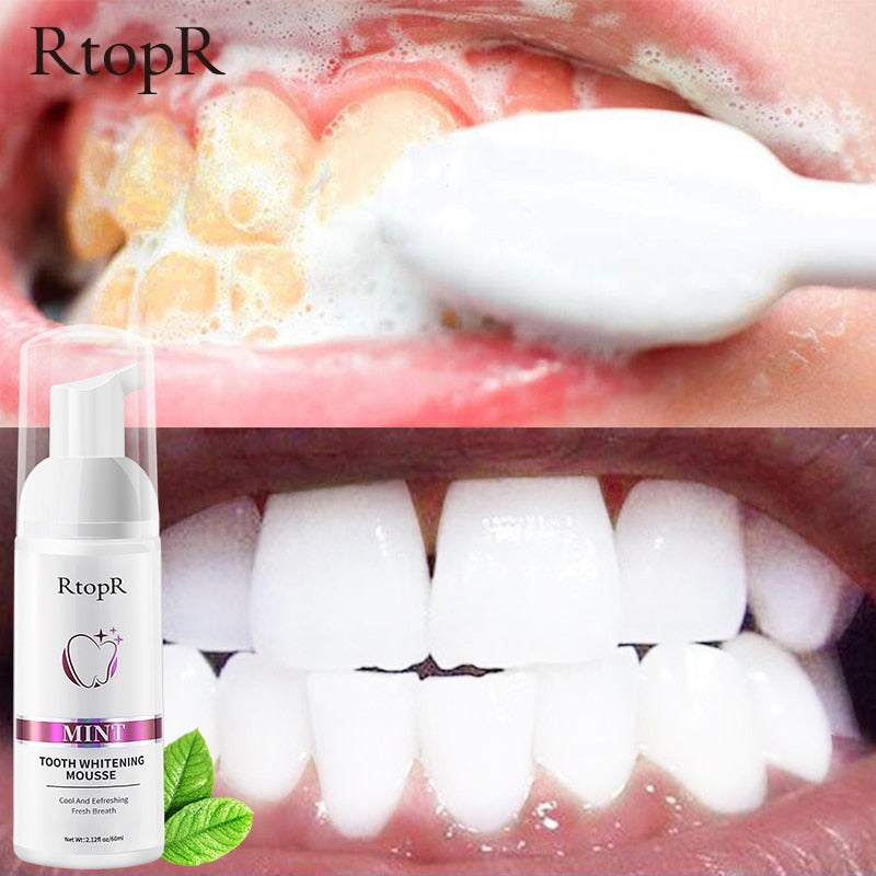 Gentle Teeth Whitening Mousse for Stain Removal