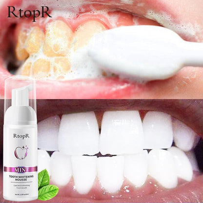 Gentle Teeth Whitening Mousse for Stain Removal