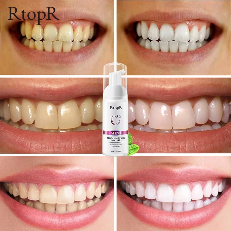 Gentle Teeth Whitening Mousse for Stain Removal