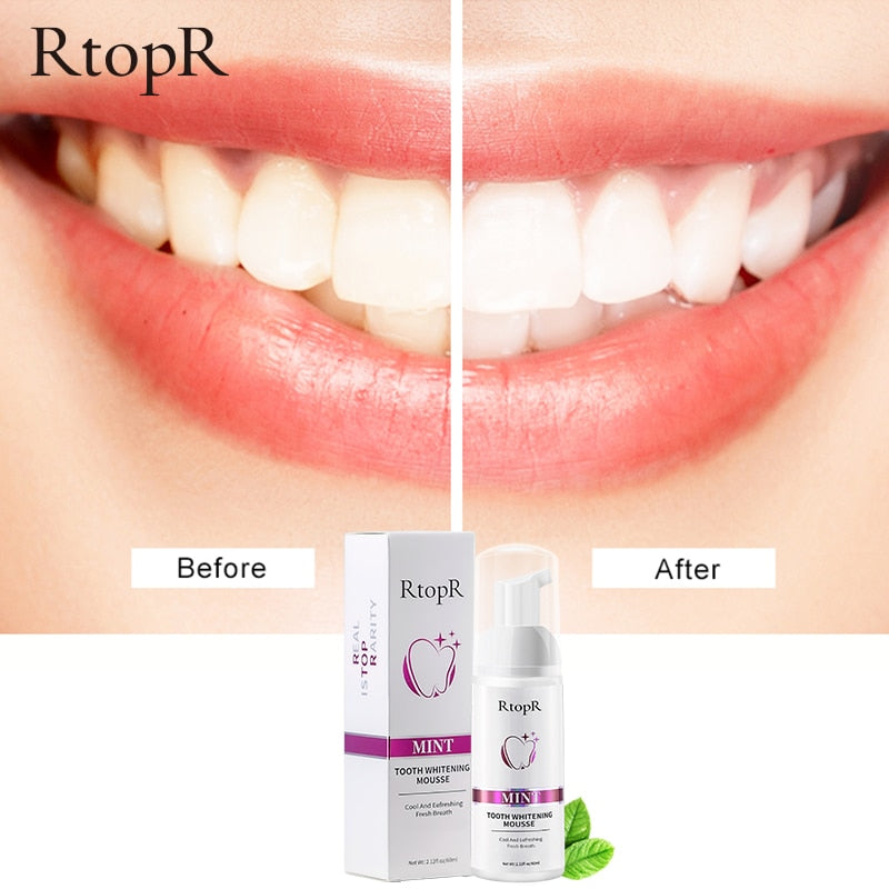 Gentle Teeth Whitening Mousse for Stain Removal
