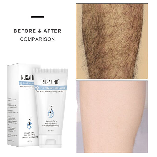 Painless Hair Removal Tool for Body & Sensitive Areas